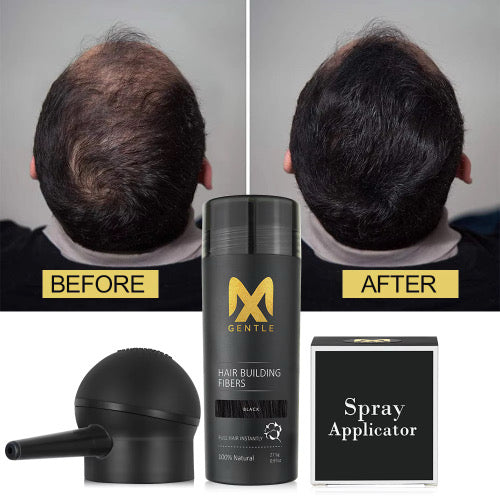 MX Gentle Hair Building Fibers Kit – Instant Full Hair & Spray Applicator (Black)